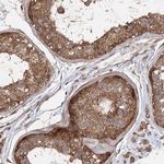 PACS1 Antibody in Immunohistochemistry (IHC)