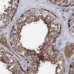 PTDSS2 Antibody in Immunohistochemistry (Paraffin) (IHC (P))