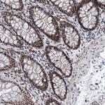 ZCCHC10 Antibody in Immunohistochemistry (Paraffin) (IHC (P))