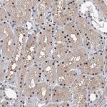 ZCCHC10 Antibody in Immunohistochemistry (Paraffin) (IHC (P))