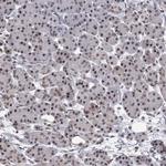 ZCCHC10 Antibody in Immunohistochemistry (Paraffin) (IHC (P))