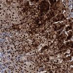 MBD6 Antibody in Immunohistochemistry (Paraffin) (IHC (P))