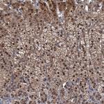 MBD6 Antibody in Immunohistochemistry (IHC)