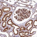 ANO6 Antibody in Immunohistochemistry (Paraffin) (IHC (P))