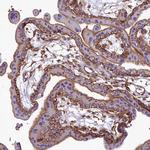 ANO6 Antibody in Immunohistochemistry (Paraffin) (IHC (P))