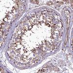 ANO6 Antibody in Immunohistochemistry (Paraffin) (IHC (P))