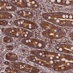 NUDT15 Antibody in Immunohistochemistry (Paraffin) (IHC (P))