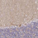 SERP1 Antibody in Immunohistochemistry (Paraffin) (IHC (P))