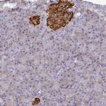 SERP1 Antibody in Immunohistochemistry (Paraffin) (IHC (P))