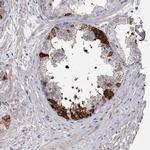 FDXACB1 Antibody in Immunohistochemistry (Paraffin) (IHC (P))