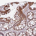 VPS11 Antibody in Immunohistochemistry (Paraffin) (IHC (P))