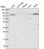 VPS11 Antibody in Western Blot (WB)