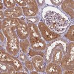 METTL20 Antibody in Immunohistochemistry (Paraffin) (IHC (P))