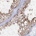 ACRBP Antibody in Immunohistochemistry (Paraffin) (IHC (P))