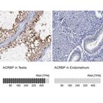 ACRBP Antibody in Immunohistochemistry (IHC)