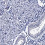 ACRBP Antibody in Immunohistochemistry (IHC)