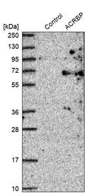 ACRBP Antibody in Western Blot (WB)