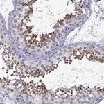 ACRBP Antibody in Immunohistochemistry (IHC)