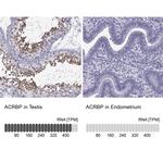 ACRBP Antibody