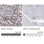 AKAP11 Antibody in Immunohistochemistry (IHC)