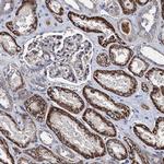 AKAP11 Antibody in Immunohistochemistry (IHC)