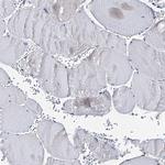 AKAP11 Antibody in Immunohistochemistry (IHC)