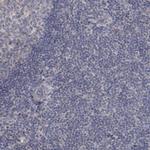 MUCL1 Antibody in Immunohistochemistry (Paraffin) (IHC (P))