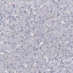 MUCL1 Antibody in Immunohistochemistry (IHC)