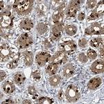 MUCL1 Antibody in Immunohistochemistry (IHC)