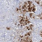 MUCL1 Antibody in Immunohistochemistry (IHC)