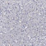 MUCL1 Antibody in Immunohistochemistry (IHC)