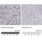 MYO7B Antibody in Immunohistochemistry (IHC)