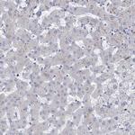 MYO7B Antibody in Immunohistochemistry (IHC)