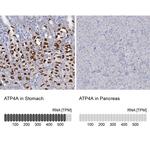 ATP4A Antibody in Immunohistochemistry (IHC)