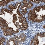 GADL1 Antibody in Immunohistochemistry (Paraffin) (IHC (P))