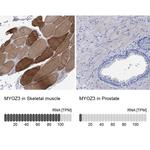 MYOZ3 Antibody in Immunohistochemistry (IHC)