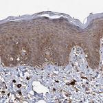 IDI1 Antibody in Immunohistochemistry (Paraffin) (IHC (P))