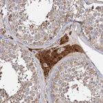 IDI1 Antibody in Immunohistochemistry (Paraffin) (IHC (P))