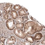 OTUB1 Antibody in Immunohistochemistry (Paraffin) (IHC (P))