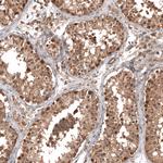 OTUB1 Antibody in Immunohistochemistry (Paraffin) (IHC (P))