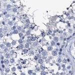 NRIP2 Antibody in Immunohistochemistry (IHC)