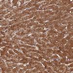 FUOM Antibody in Immunohistochemistry (IHC)