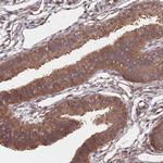 UNC45A Antibody in Immunohistochemistry (Paraffin) (IHC (P))