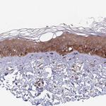 UNC45A Antibody in Immunohistochemistry (Paraffin) (IHC (P))