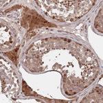 UNC45A Antibody in Immunohistochemistry (Paraffin) (IHC (P))