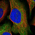 SDS Antibody in Immunocytochemistry (ICC/IF)