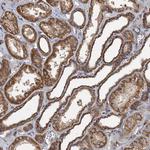 SDS Antibody in Immunohistochemistry (Paraffin) (IHC (P))