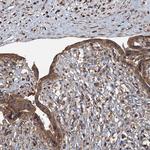 SDS Antibody in Immunohistochemistry (Paraffin) (IHC (P))