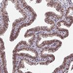 BANF1 Antibody in Immunohistochemistry (Paraffin) (IHC (P))