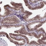 BANF1 Antibody in Immunohistochemistry (IHC)